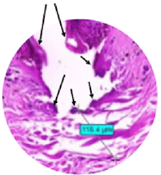 Protein Coagulation